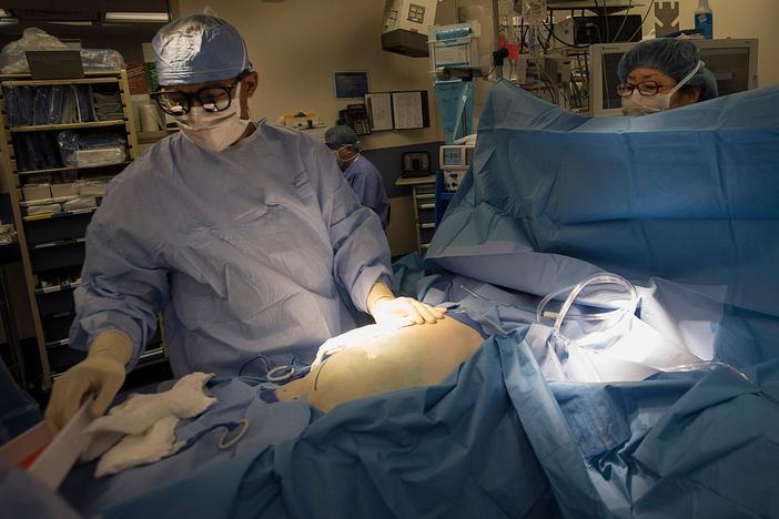 How America’s organ transplant system can be improved