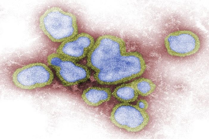 Digitally-colorized image of a collection of influenza A virions.