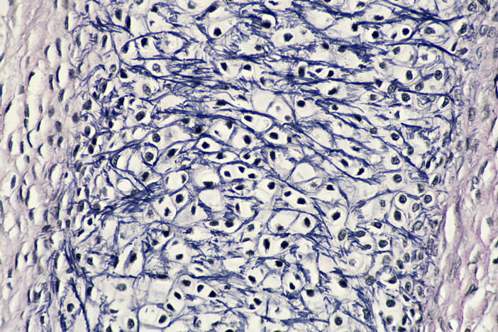 Human fetal tissue (stock photo)
