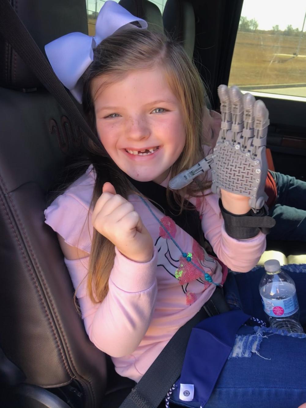 8-year-old Lilly Phagan shows off her newly 3D printed prosthetic hand.