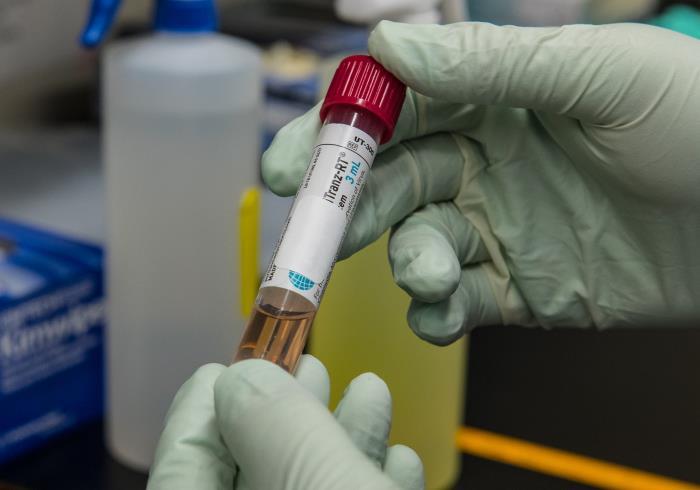 COVID-19 sample waiting to be tested