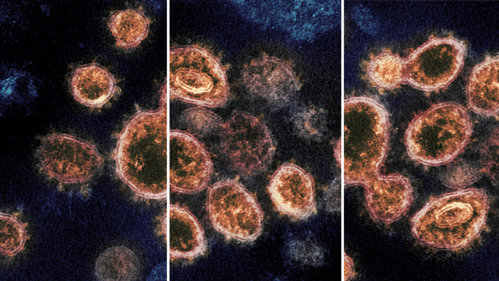 Images of the COVID-19 virus.