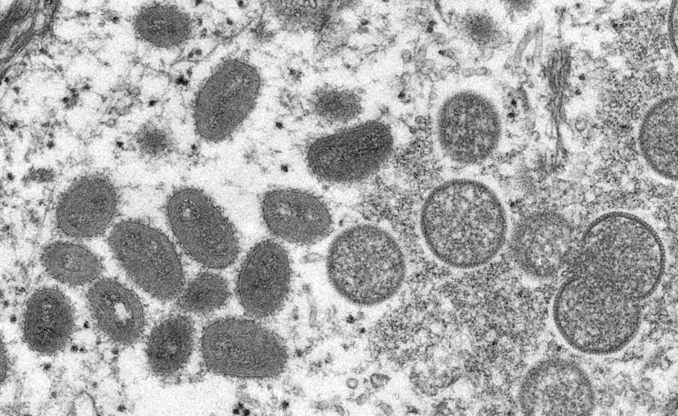The monkeypox virus