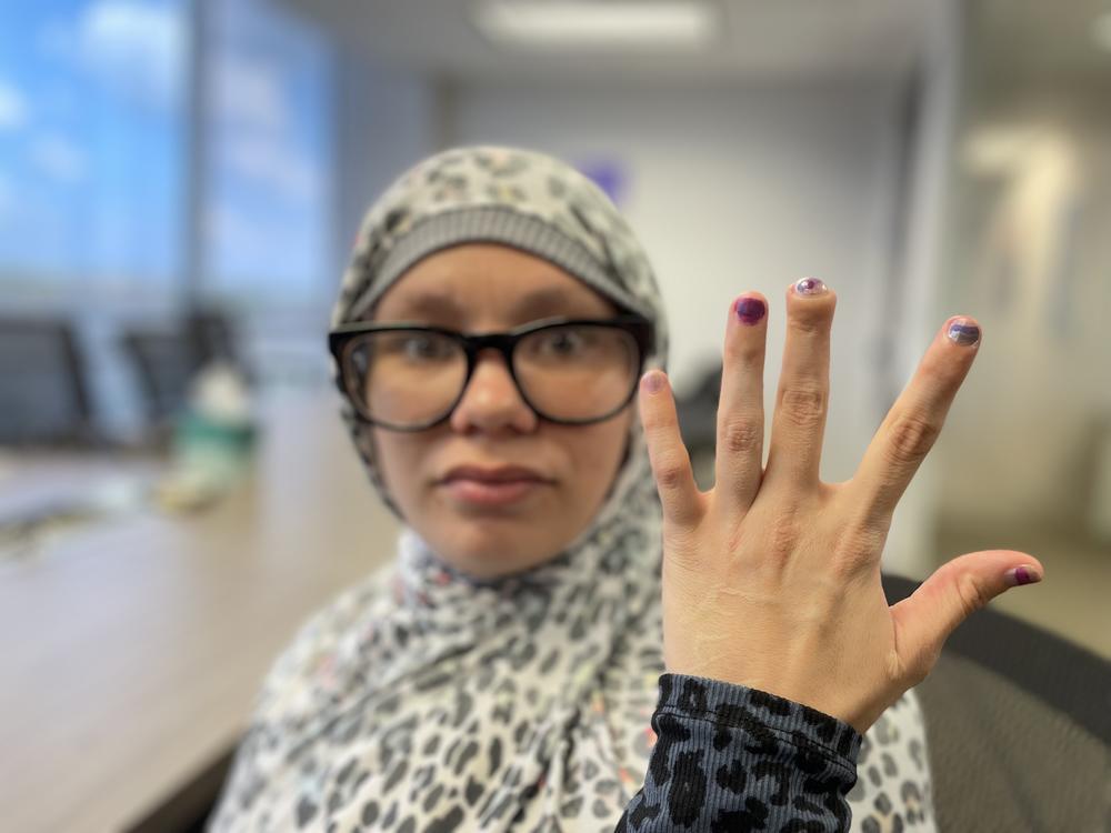 Nova Jaswan hold up her hand showing where her middle finger was damaged by a jail cell door