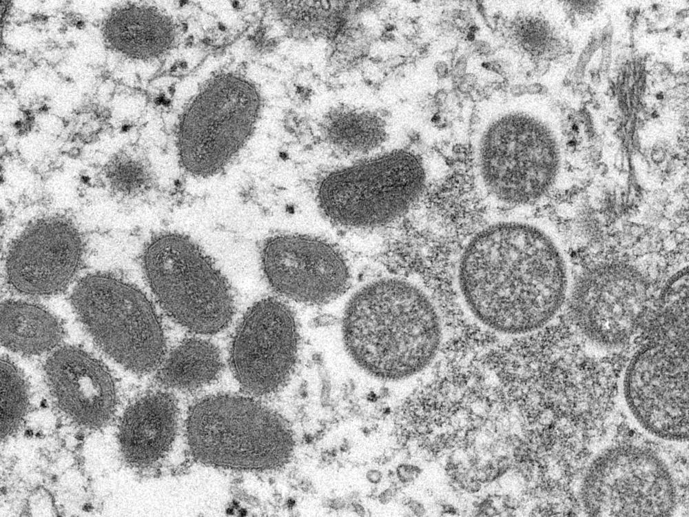 This 2003 electron microscope image made available by the Centers for Disease Control and Prevention shows mature, oval-shaped monkeypox virions, left, and spherical immature virions, right, obtained from a sample of human skin associated with the 2003 prairie dog outbreak.