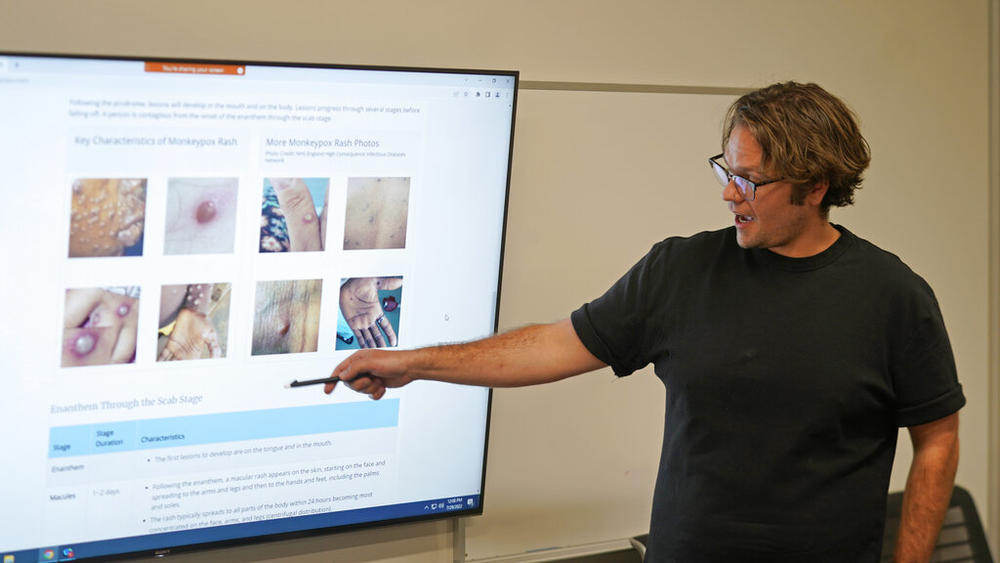 a man points to images of monkeypox rashes