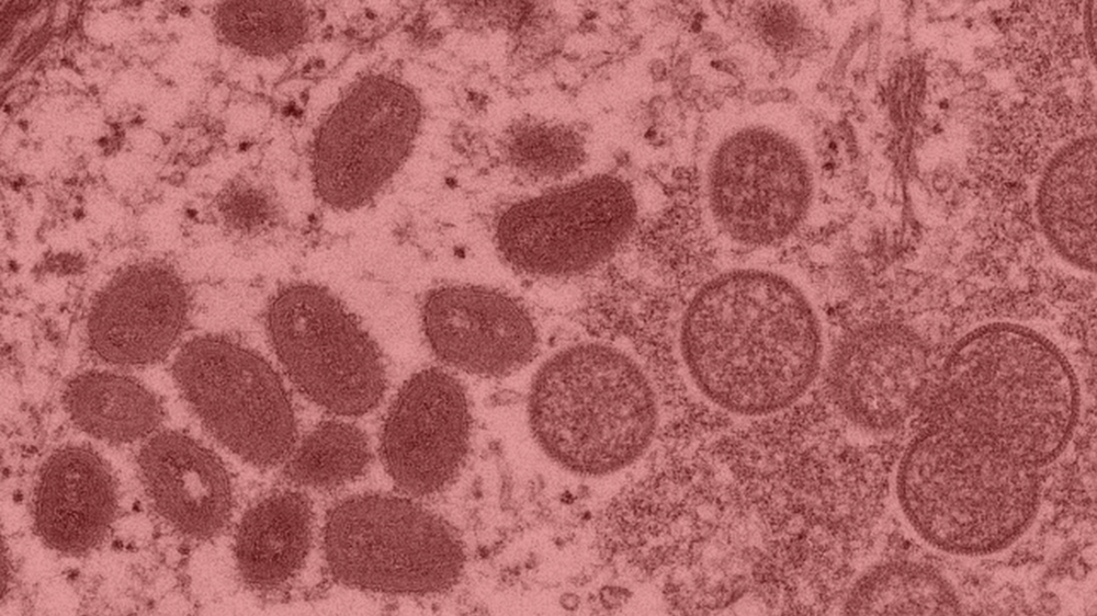 A red-shaded version of a 2003 microscopic image of the oval-shaped monkeypox virus. 