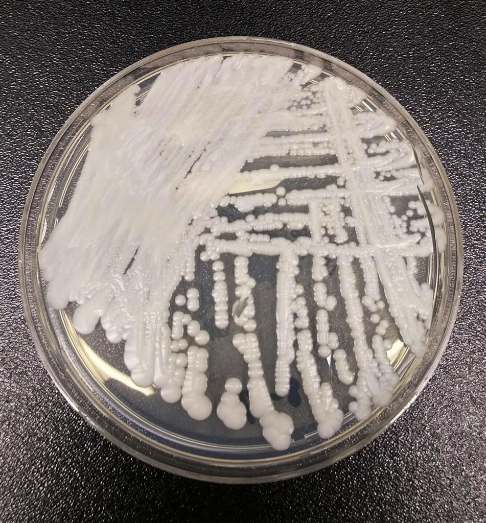 A strain of Candida auris cultured in a petri dish.