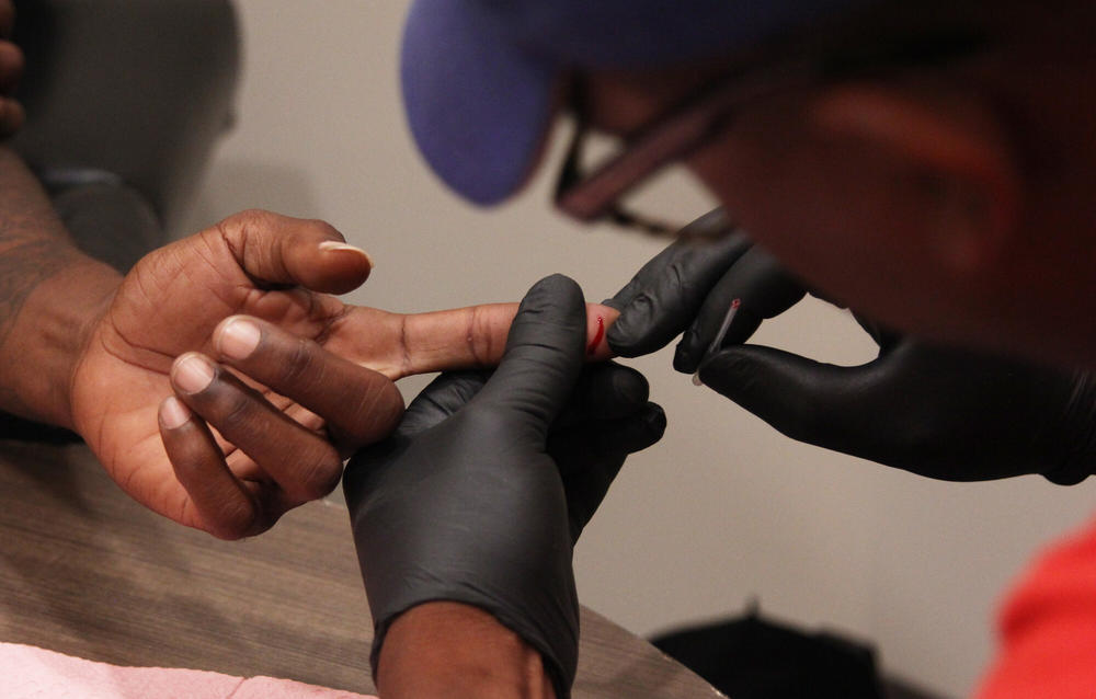 A close up image of an HIV finger prick test