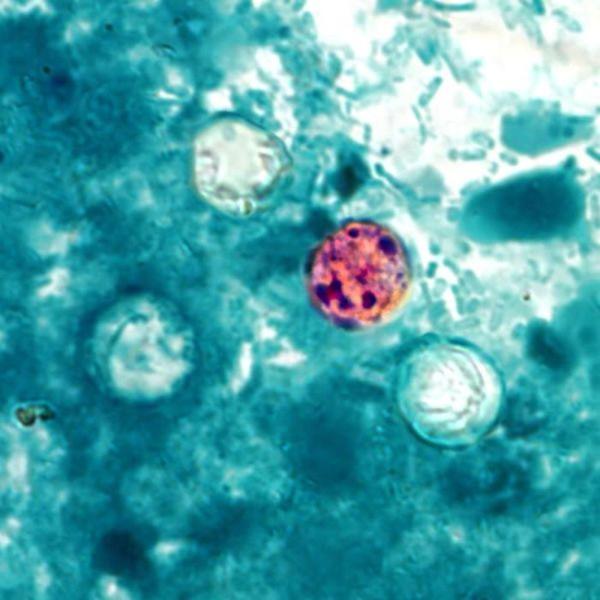 Courtesy, <a href="http://commons.wikimedia.org/wiki/File:Cyclospora_cayetanensis.jpg" target="_blank">Wikimedia</a>