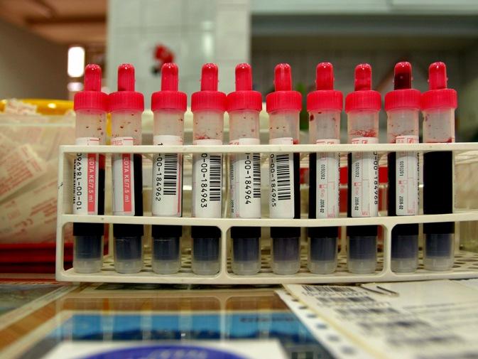 home test for lead poisoning