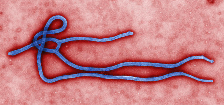 The Ebola virus 