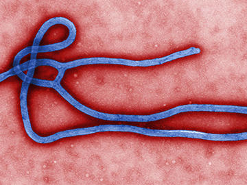 Ebola virus