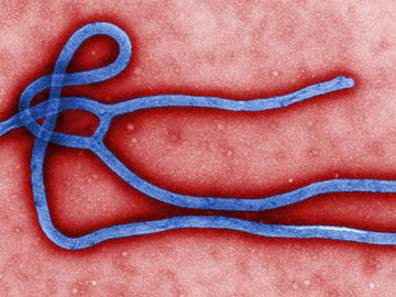 Ebola virus image