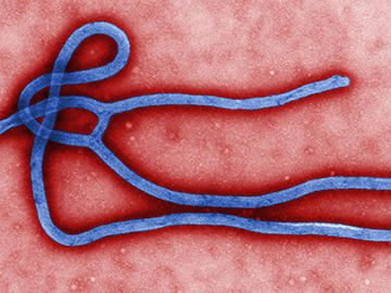 Ebola virus image Ebola virus image