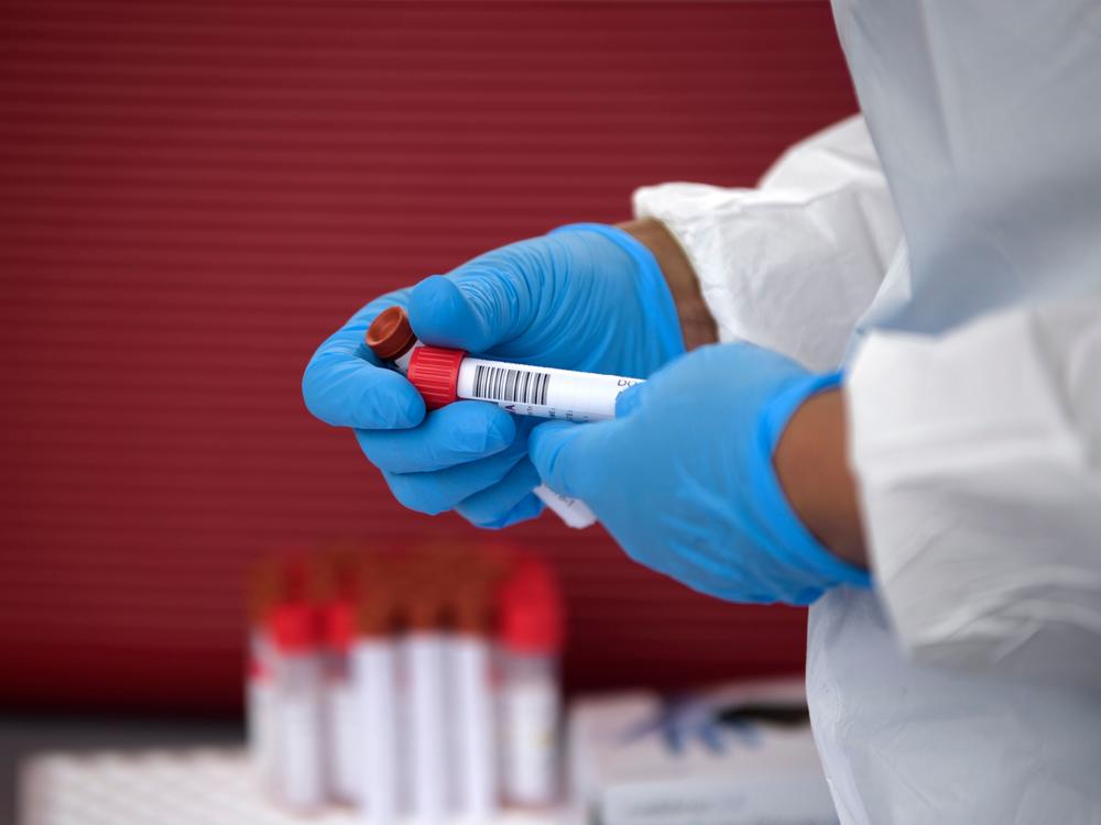 A health care worker organizes coronavirus tests that were administered at a United Memorial Medical Center testing site in Houston on June 25.