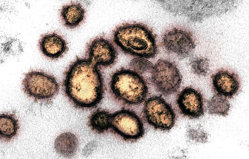 This transmission electron microscope image shows SARS-CoV-2, the virus that causes COVID-19, isolated from a patient in the U.S.
