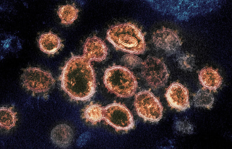 This transmission electron microscope image shows SARS-CoV-2, the virus that causes COVID-19, isolated from a patient in the U.S. The spikes on the outer edge of the virus particles give coronaviruses their name, crown-like.