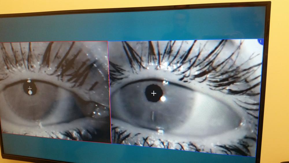 An eye-map at the Vital Life Health Center measures reflex and pupil dilation of a patient