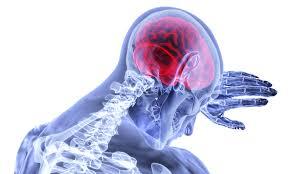According to the CDC, Georgia's stroke death rate was 14 percent higher than the national rate in 2013.