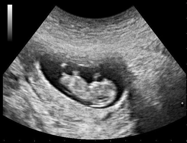Looming Georgia state budget cuts has Morehouse School of Medicine re-evaluating how to fund its Center for Excellence on Maternal Mortality.