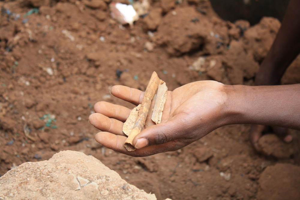 A man holds what appear to be bone fragments found at a mass grave.