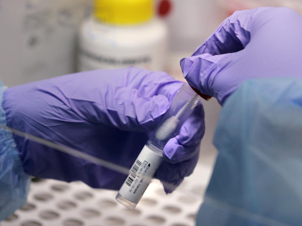 The federal government is giving out funds to develop seven new testing technologies which could increase testing capacity around the U.S.