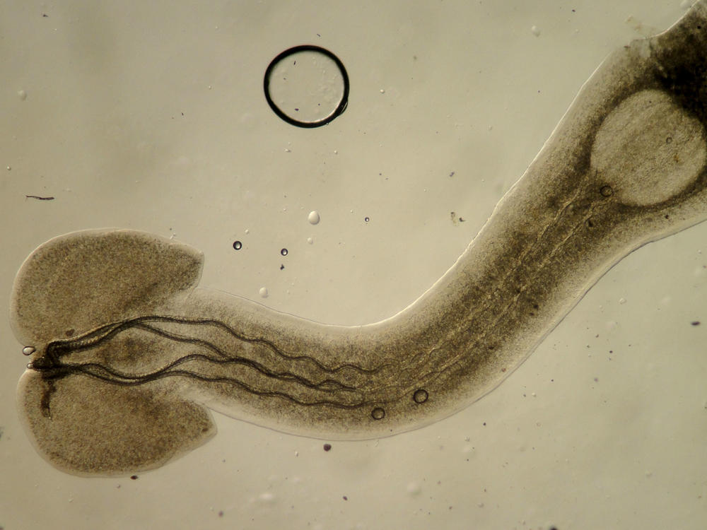 Parasites play crucial roles in keeping ecosystems healthy, as does this larval trypanorhynch tapeworm, which infects fish.