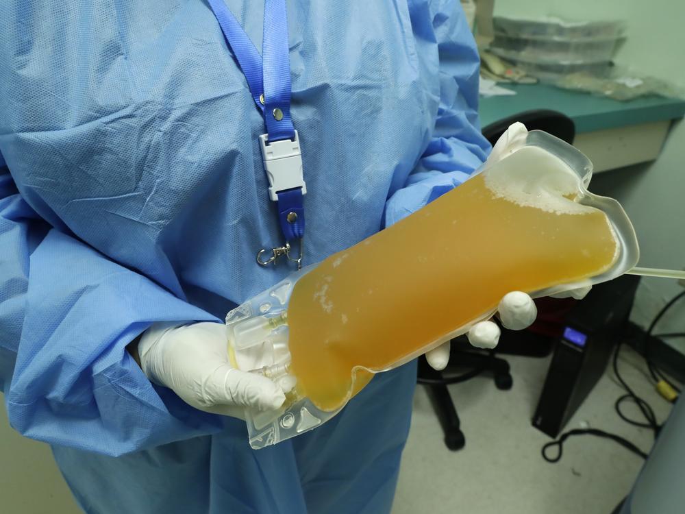 Convalescent serum or blood plasma from a recovered COVID-19 patients is being studied as a treatment for others with the disease. The FDA is holding off on giving it emergency use authorization.