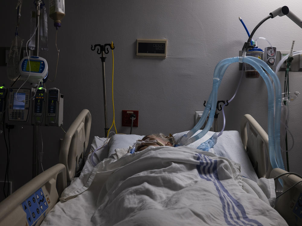 A COVID-19 patient in the intensive care unit at United Memorial Medical Center in Houston on July 28.