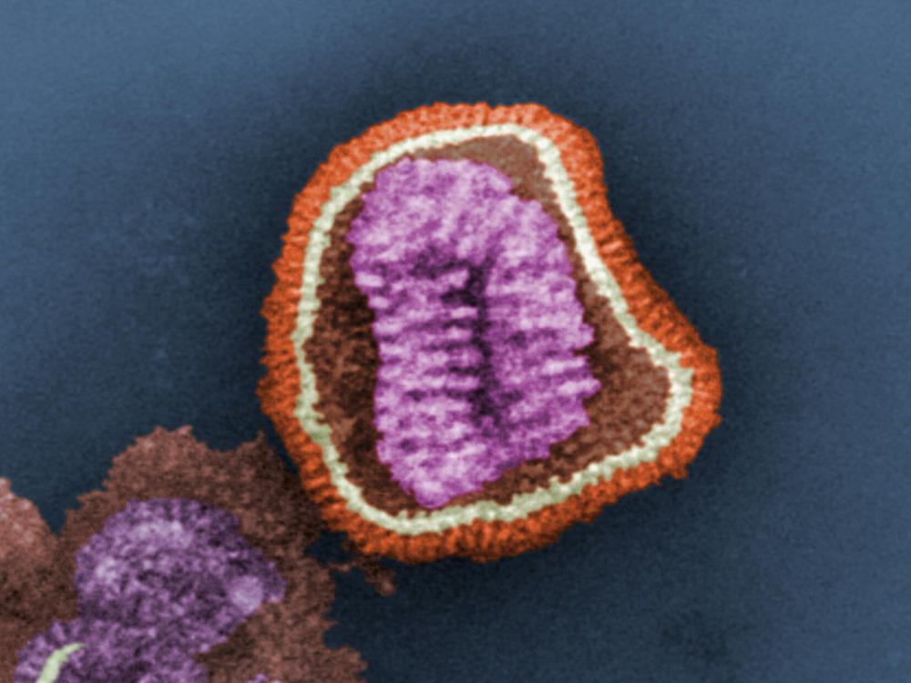 This negative-stained transmission electron micrograph depicts the ultrastructural details of an influenza virus particle, or virion.