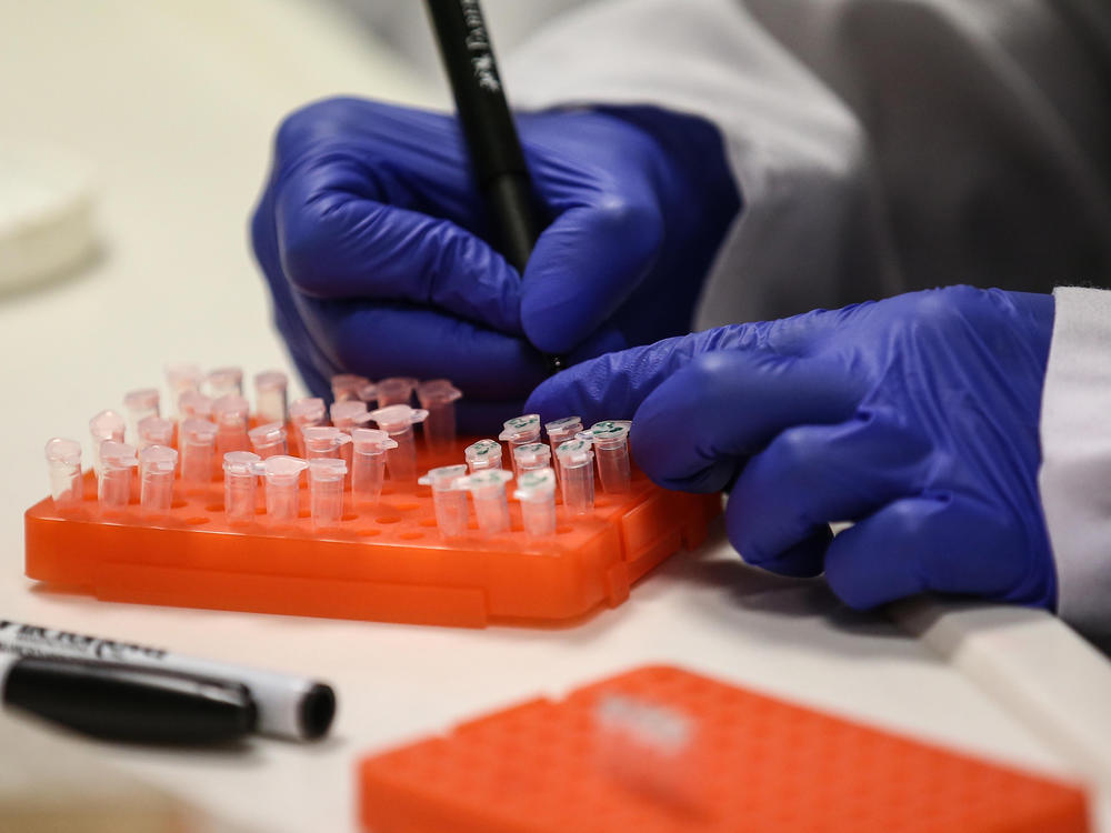 A scientist at work on a COVID-19 vaccine candidate at Bogazici University in Istanbul in August.