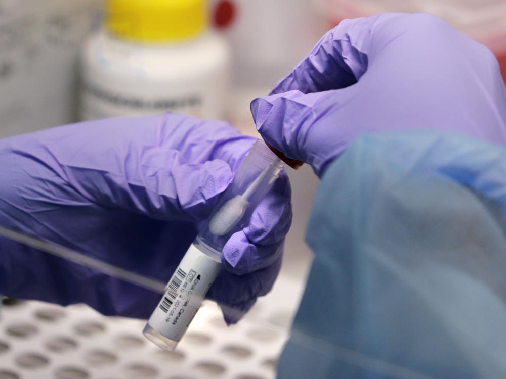 Massachusetts parents sent their child to Attleboro High School despite knowing the teenager was infected with the coronavirus. Above, a coronavirus test is performed at Boston University in July.
