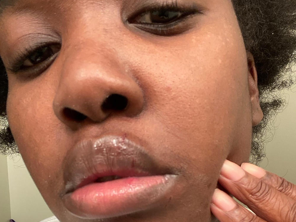 This undated selfie photo provided by Rickia Young shows her lip. Attorney Kevin Mincey, who represents Young, says she went to retrieve her 16-year-old nephew from the area were a protest was occurring, and put her 2-year-old son in the car to help him fall asleep.