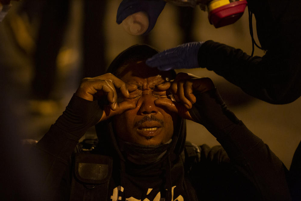 A counterprotester gets treatment after an irritant was sprayed into his eyes by police.
