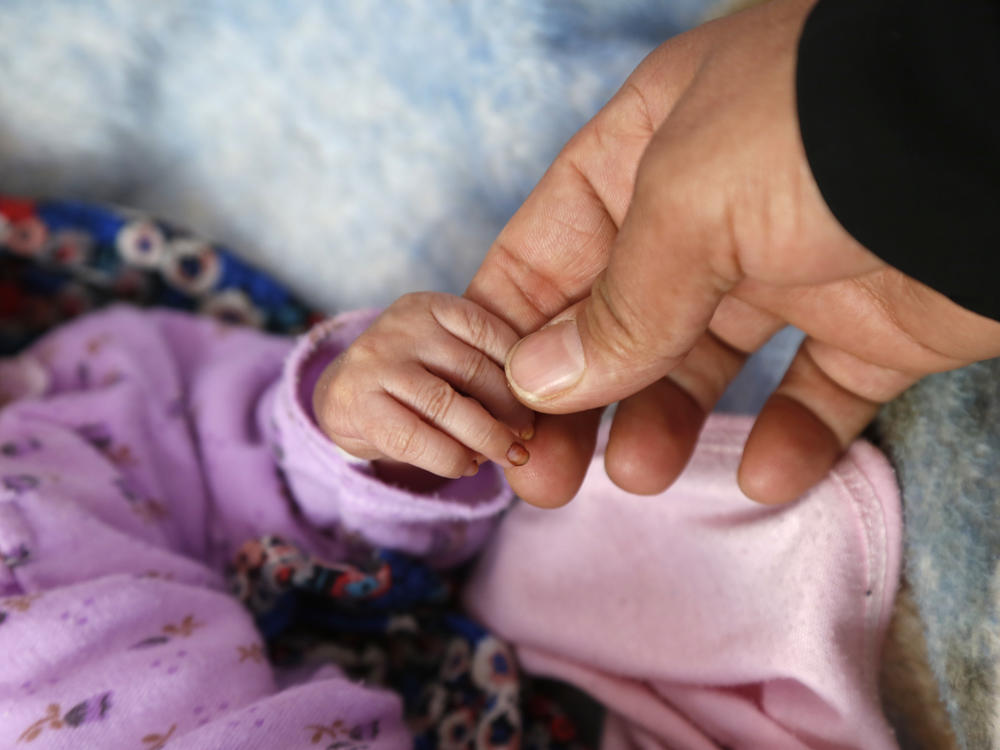 A nurse checks a child who is receiving treatment for malnutrition at a hospital in Sana'a, Yemen. The photo was taken on December 13.<strong></strong>