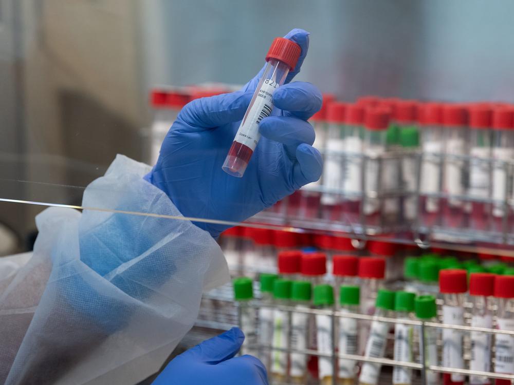 A laboratory technician is pictured handling swab samples at a hospital in Mulhouse, France, in November. French officials confirmed the country's first case of the new coronavirus variant on Friday.