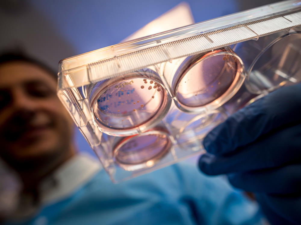 University of California, San Diego scientist Alysson Muotri's lab grew brain organoids from human stem cells that swapped a developmental gene from Neanderthals for the human version.