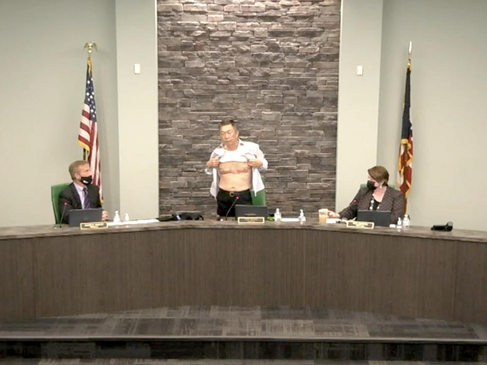 West Chester, Ohio, Board of Trustees Chairman Lee Wong bares his chest at a meeting Tuesday. Those scars, suffered during his U.S. military service, are 
