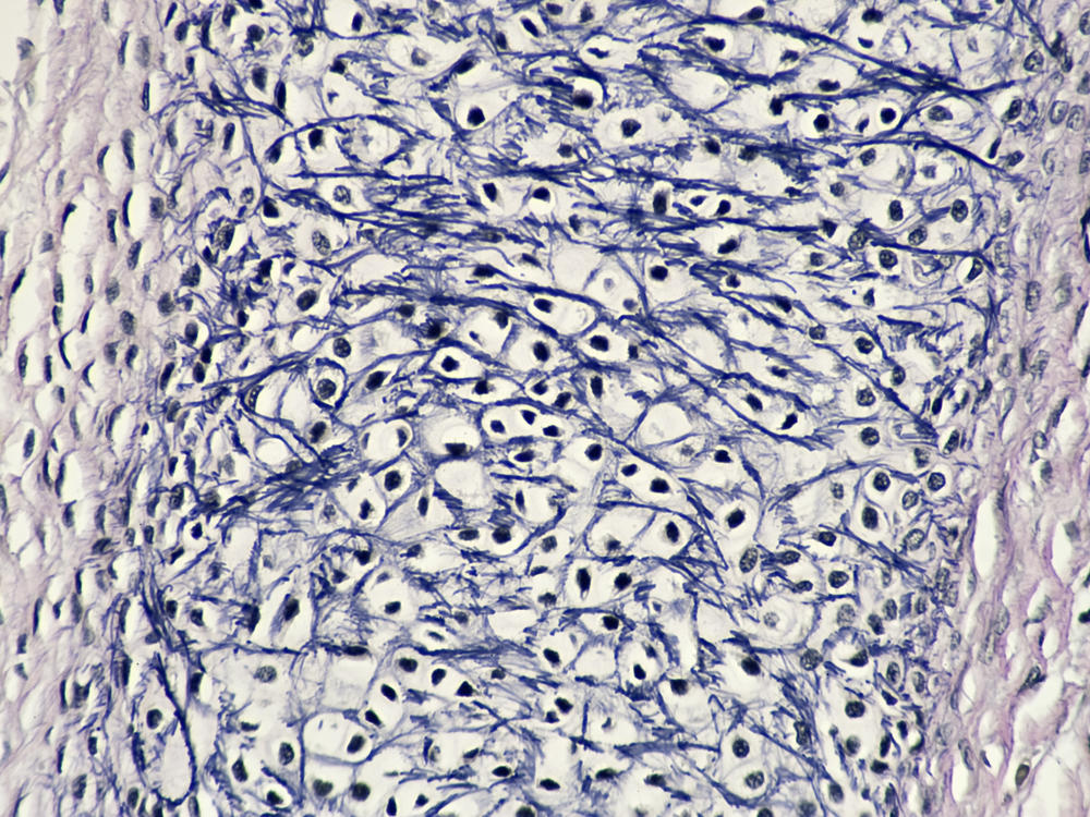 Human fetal tissue (stock photo)