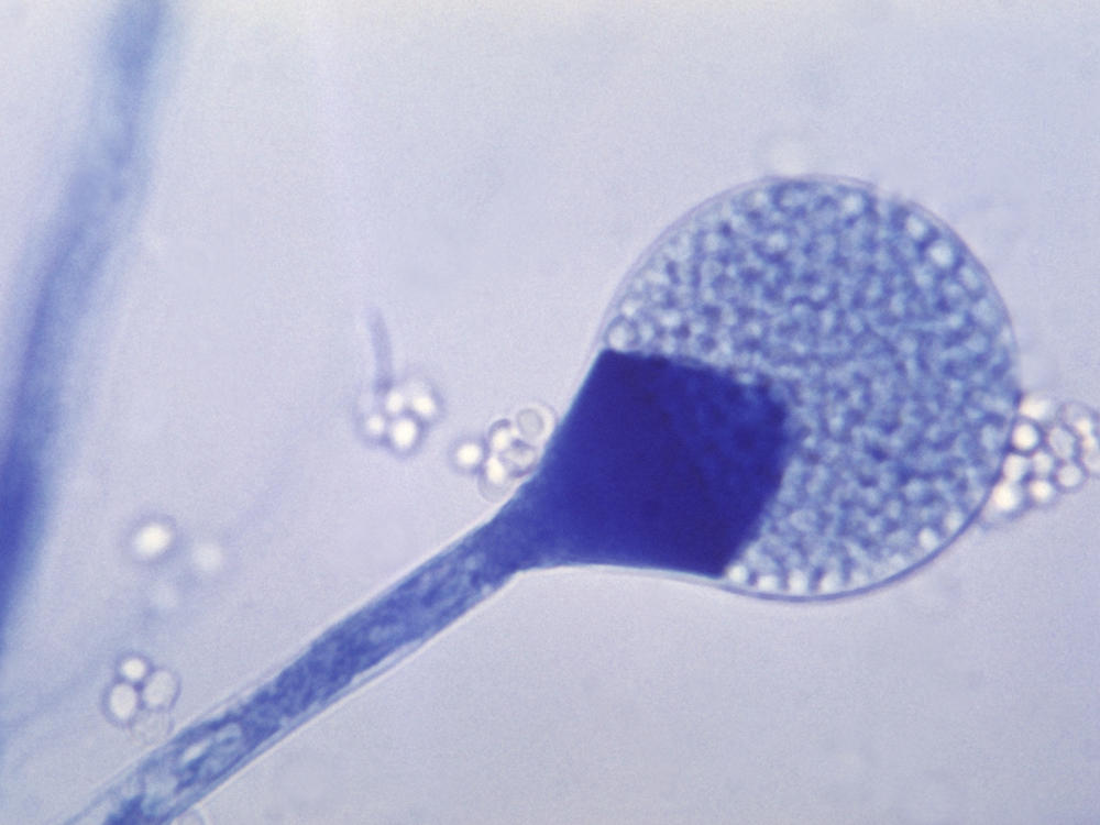 A light micrograph of a mature sporangium of a mucor fungus. India is seeing a rise in cases of mucormycosis, a rare but dangerous fungal infection.