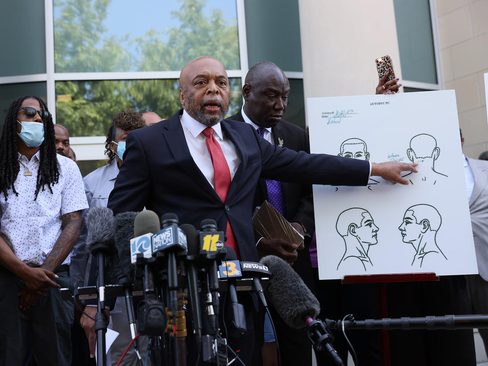 Speaking to reporters on April 27 in Elizabeth City, N.C., Wayne Kendall, one of the lawyers representing the family of Andrew Brown Jr., points to an autopsy chart showing where Brown was shot.