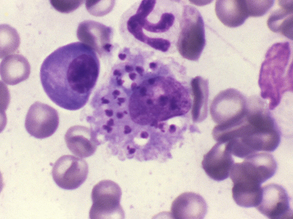 This photomicrograph depicts <em>Leishmania donovani</em> parasites contained within a canine bone marrow cell. O<em>ne of the more dangerous of 20 d</em>ifferent species of <em>Leishmania</em>,<em> L. <em>donovani </em>is endemic to parts of India, Africa, and South-West Asia.</em>