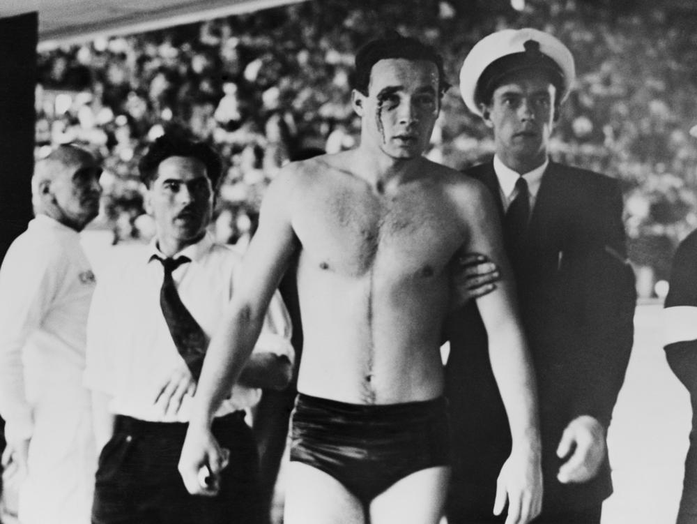 Hungary's Ervin Zador is led from the pool with blood pouring from a cut eye after a water polo match with the Soviet Union descended into chaos at the 1956 Melbourne Olympics. The Games played out in a volatile time — and thanks to a 17-year-old's letter, they ended on a note of unity.