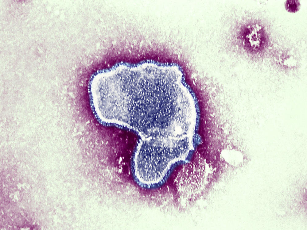 At the moment there is little data available on the impact of contracting COVID-19 and the respiratory syncytial virus (pictured), and whether together they can make a person sicker. But health officials worry it could put young patients — who are not eligible for the coronavirus vaccine — at greater risk.