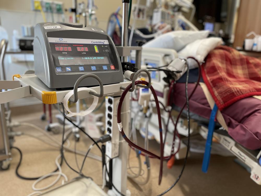 ECMO is the highest level of life support — beyond a ventilator, which pumps oxygen via a tube through the windpipe into the lungs. Instead, the ECMO process basically functions as a heart and lungs outside of the body — routing the blood via tubing to a machine that oxygenates it, then pumps it back into the patient.