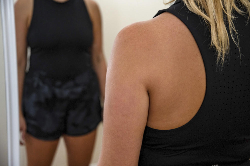 Ornella Corazza, a professor of addictive behavior at the University of Hertfordshire, says there was more anxiety about body image during the lockdown.