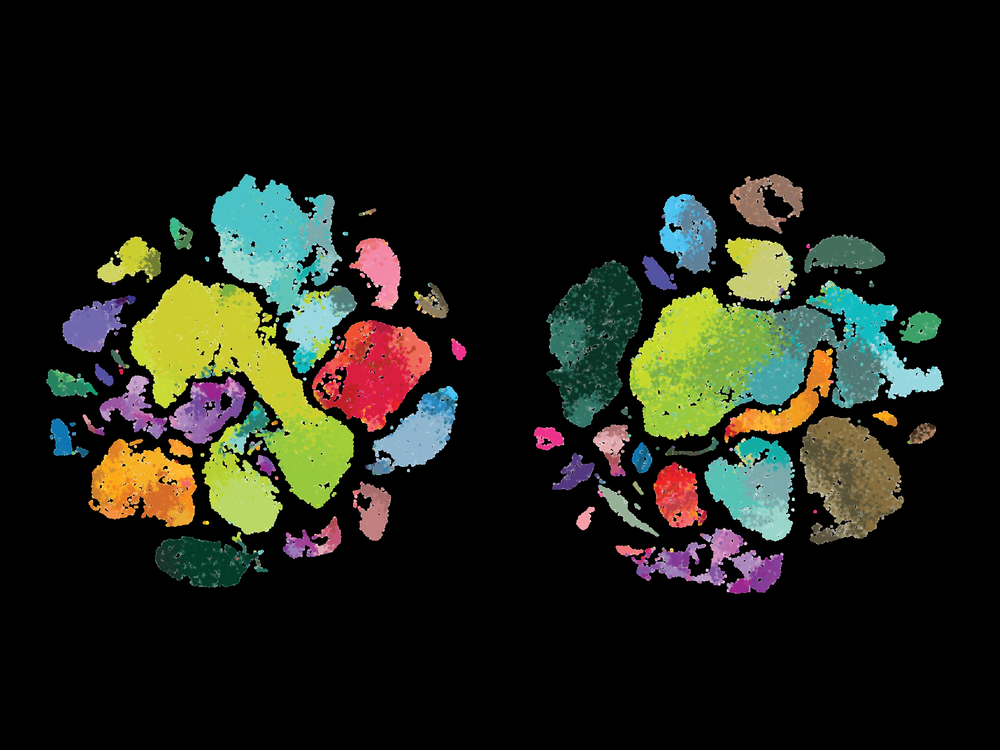 Scientists at the Allen Institute for Brain Science uncovered differences among human brain cells (left) those of the marmoset monkey (middle) and mouse in a brain region that controls movement, the primary motor cortex.