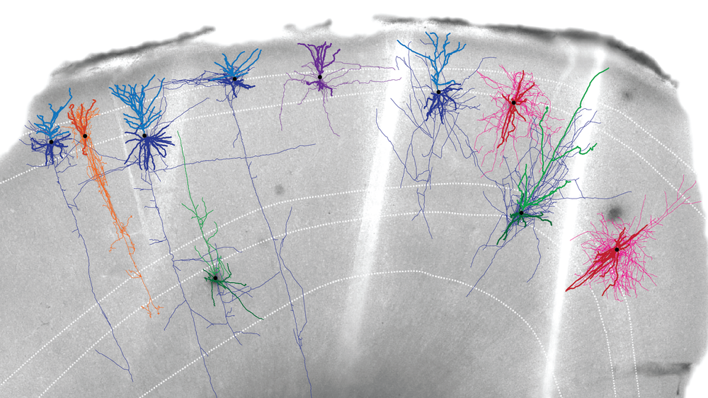 Stained neurons shown in a slice of brain tissue donated by a brain surgery patient.