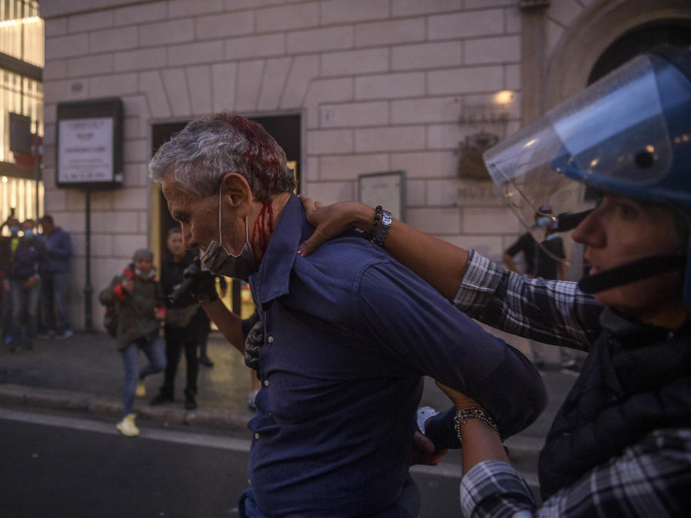 A wounded demonstrator clashes with the Italian police during a demonstration against the 